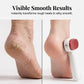 🔥Last Day Hot Sales - 59% OFF😍2-in-1 Double-Sided Foot Callus Remover – Hard Skin & Dead Skin Scraper ✨