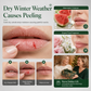 🎅Early Xmas Sales - 50% OFF🎄Christmas Fruity Lip Balm Set 💋Long‑Lasting Moisturizing Lip Care Sticks For Dry Chapped Lips
